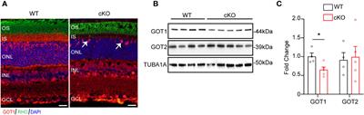 Rod photoreceptor-specific deletion of cytosolic aspartate aminotransferase, GOT1, causes retinal degeneration